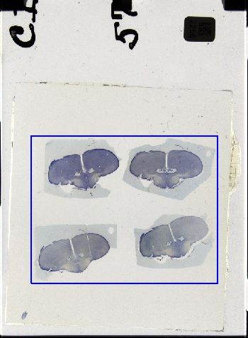 Media type: image; Special Collections 3298   shows specimen_part histological serial section;